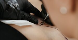 découvrez nos solutions efficaces pour l'élimination de l'encre de tatouage, avec des techniques sûres et adaptées à votre peau.